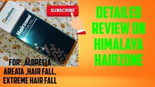 Review on Himalaya Hairzon solution for Alopecia areata, Pattern Hairloss.My vlogs by Saanvi.