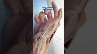 Basal Joint Surgery (3D Animation)
