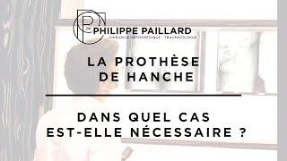 Prothèse de la hanche, à quoi ça sert ?