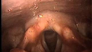 Laryngeal Examination