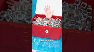 How A Hand Transplant Works  Surgeon Reacts