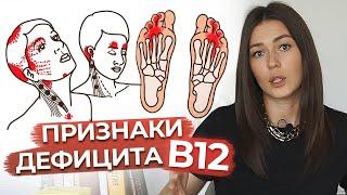 Проблемы с памятью? / Чем опасен дефицит витамина В12? / Лучшие источники витамина В12