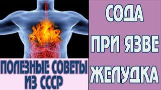 Сода при язве желудка. Как сода помогает при изжоге. Как использовать соду от изжоги. Совет врача