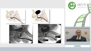 Котов С В - Рекомендации EAU и AUA по лечению стриктур уретры
