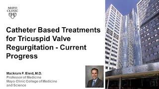 Catheter Based Treatments for Tricuspid Valve Regurgitation – Current Progress