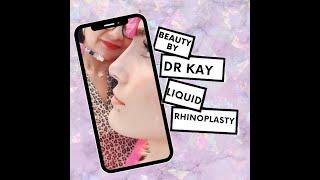 EP #14 :Dr. Kay Durairaj Beauty By Dr. Kay Perform A Liquid Rhinoplasty On Whitney