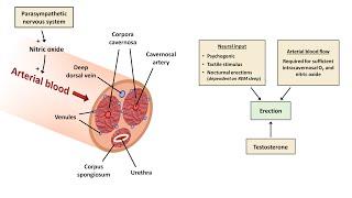 An Approach to Erectile Dysfunction