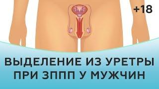 Выделение из уретры при ЗППП у мужчин