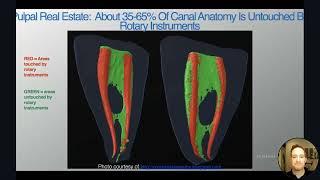 CE Webinar: A Novel Approach to Endodontic Irrigation