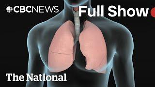 CBC News: The National | Walking pneumonia warnings