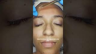 BSK8 SCARPRO – Repair Acne Scars & Boost Skin Clarity