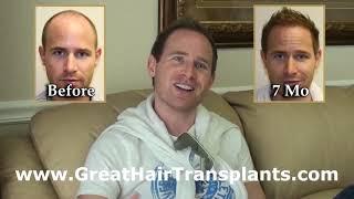 Women's Hair Transplant Surgery In Wausau, Wisconsin - Dr. Brett Bolton