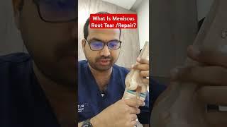 What Is Meniscus Root Tear /Repair?  Dr Sai Chandra MBBS DNB Ortho Hyderabad