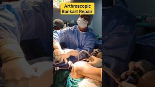 Recurrent Shoulder Dislocation SurgeryBankart Repair#shoulderdislocation #shouldersurgeon#shoulder