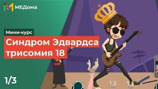 Синдром Эдвардса - трисомия 18 / USMLE step 1 | Медома