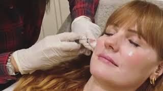 Profhilo® treatment with Dr Chloë at Eighth & Eden in Worcestershire