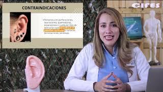 Beneficios generales de la auriculoterapia técnicas chinas acupuntura que es y para que sirve puntos