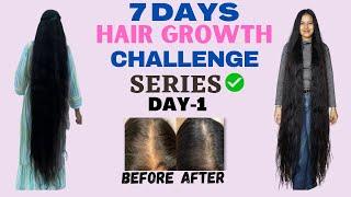 Day-1 HAIR GROWTH challenge series|Grow your hair long |#pooja mehra#hairgrowth #hairgrowthchallange