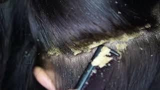 Dandruff scratching removal on head using black combing#118