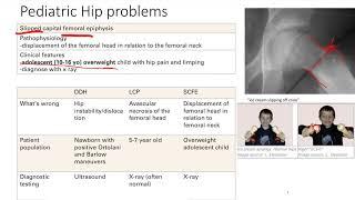 Pediatric MSK Problems | MSK | Step 1 Simplified