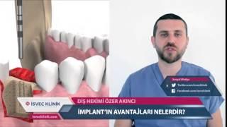 Die Vorteile und der nutzen des Implantats & İsveç Klinik