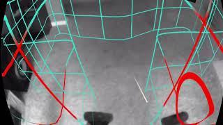 Oculus Quest: Guardian Setup and Demo