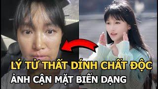 Lý Tử Thất dính chất độc, ảnh cận mặt biến dạng