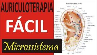 Microssistema Auricular - Acupuntura Auricular é um Microssistema