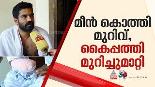 കുളം വൃത്തിയാക്കുന്നതിനിടെ മീൻ കൊത്തി, അണുബാധയെ തുടർന്ന് യുവാവിൻ്റെ കൈപ്പത്തി മുറിച്ചുമാറ്റി