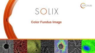 Solix Color Fundus