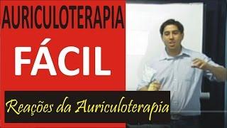 Saiba o que pode Acontecer em uma Acupuntura Auricular - Curso de Auriculoterapia