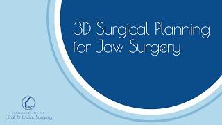 3D Surgical Planning for Jaw Surgery : Short