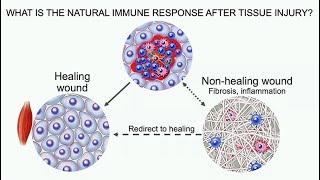 The Immune System in Regenerative Medicine