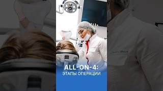 Полное восстановление улыбки по методу All-on-4