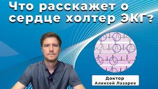 ЧТО РАССКАЖЕТ О СЕРДЦЕ ХОЛТЕР ЭКГ? #холтерЭКГ #ЭКГ #ДокторАлексейЛазарев