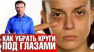 Темные круги под глазами: как избавиться? Почему появляются синяки под глазами? 