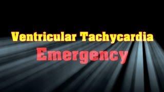 Ventricular Tachycardia Emergency