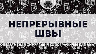 ОХиТА: Непрерывные швы (шов по Ревердену–Мультановскому, обвивной шов, непрерывный матрацный шов)