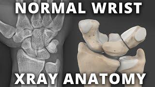 Normal wrist xray - radiographic anatomy tutorial