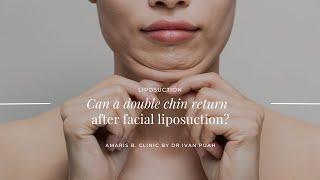 Can A Double Chin Return After Facial Liposuction? | Amaris B. Clinic by Dr Ivan Puah