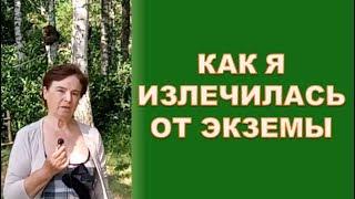 Как я излечилась от #экземы