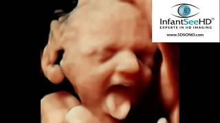 NEW 5D ULTRASOUND TECHNOLOGY AT 28 WEEKS