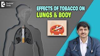 How Smoking KILLS? | Why give up Smoking? | World No Tobacco Day- Dr.Sanjay Panicker|Doctors' Circle