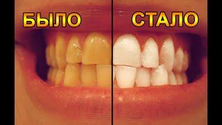 Как отбелить зубы от жёлтого налёта. Продвинутый метод!