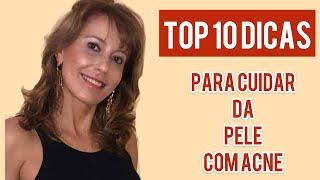 TOP 10 DICAS PARA QUEM SOFRE COM ESPINHAS !!!!