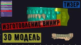 виниры в exocad. Моделирование от А до Я. Зубы в цифре. Модель для печати. 3D модель.