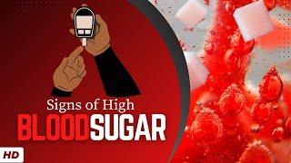 Signs Of High Blood Sugar