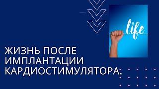 Лечение нарушений проводимости. Жизнь после имплантации кардиостимулятора.