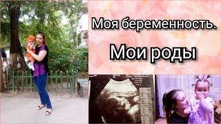 Моя история беременности. Пункция плодного пузыря. Мои роды.