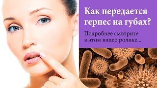 Ты ЭТО должен УВИДЕТЬ! Как передаётся герпес на губах? ШОК!